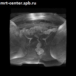 МРТ органов малого таза